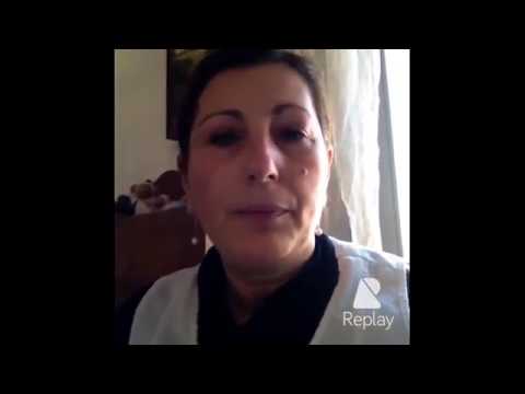 Cancellato un pigmentary notano con il laser La decolorazione di crema vitex. struttura