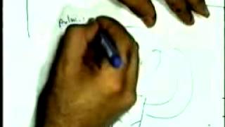 urinary bilharziasis 3 AND PULMONARY BILH. DR / SAMEH GHAZY