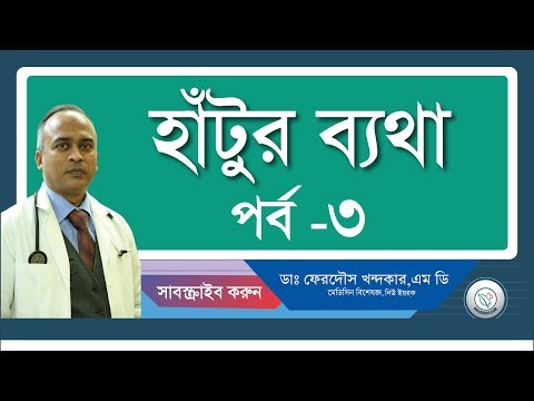 হাটুর বাত-৩: চিকিৎসা পধ্বতি।