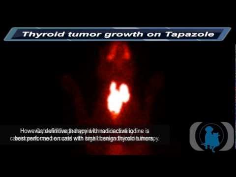 Thyroid Tumor Growth on Tapazole