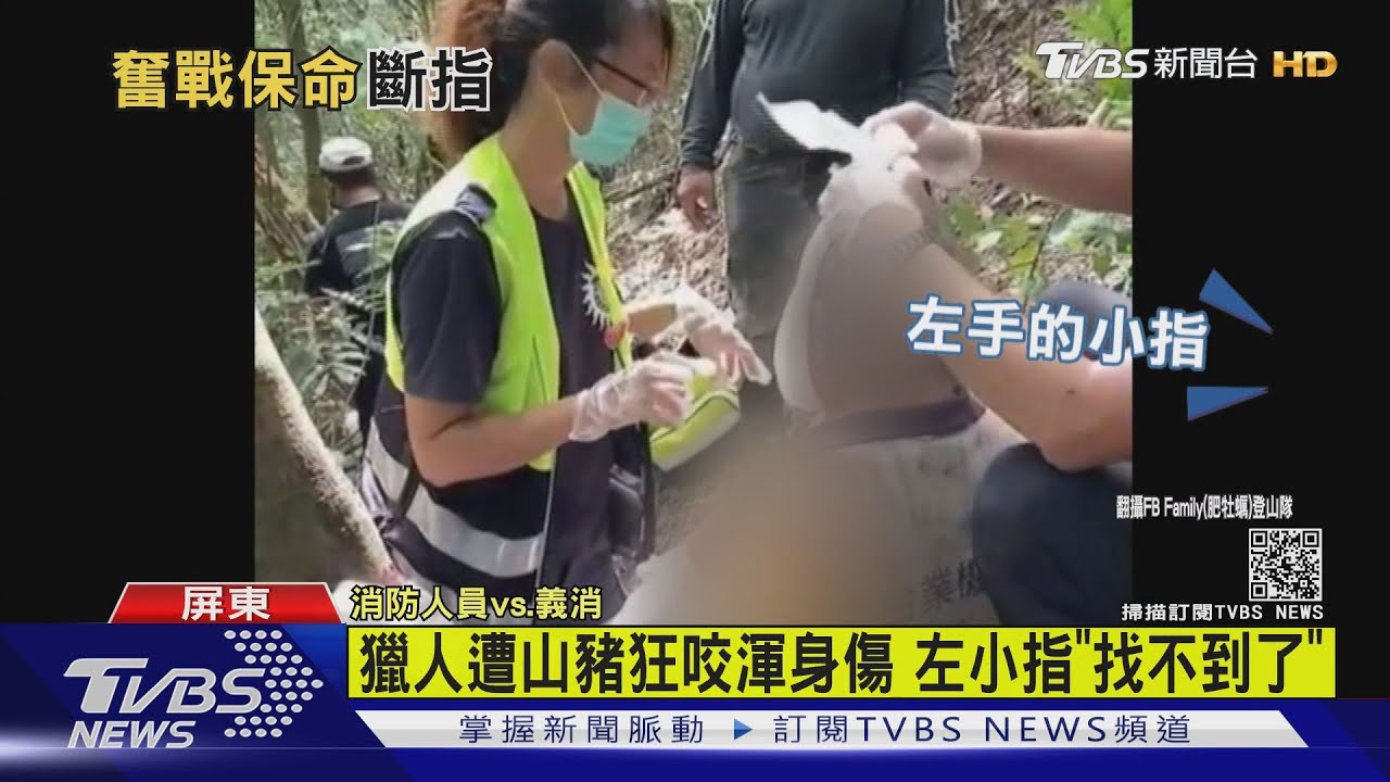 獵人遭山豬狂咬 渾身傷左小指「找不到了」