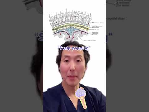 Scalp Popping! What Is It, and Why Should You Not Do It? #shorts