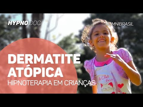Perché là non passa leczema alle dita di mani Klotrimazol da eczema
