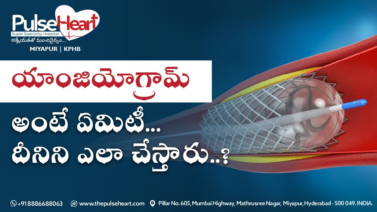 What is Angiogram Procedure? | Doctor Movva Srinivas | Pulse Heart