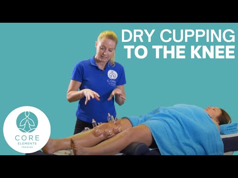 Demonstration of Dry Cupping to the knee joint