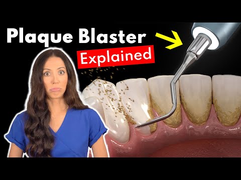 Dental Hygienist Explains Ultrasonic Scaling | Teeth Cleaning With Plaque Blaster