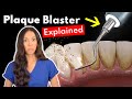 Dental Hygienist Explains Ultrasonic Scaling Teeth Cleaning With Plaque Blaster