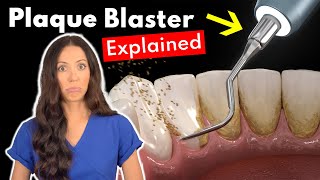 Dental Hygienist Explains Ultrasonic Scaling | Teeth Cleaning With Plaque Blaster