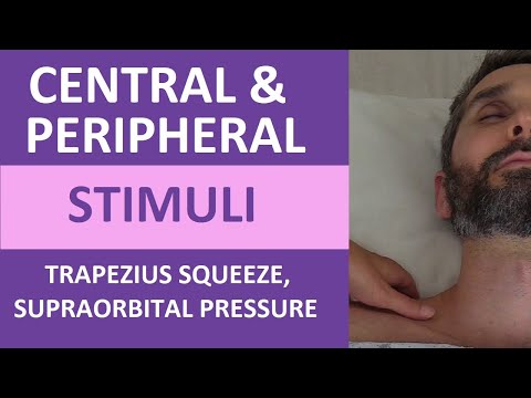 Autonomic Dysreflexia Hyperreflexia Nursing Review Symptoms Treatment