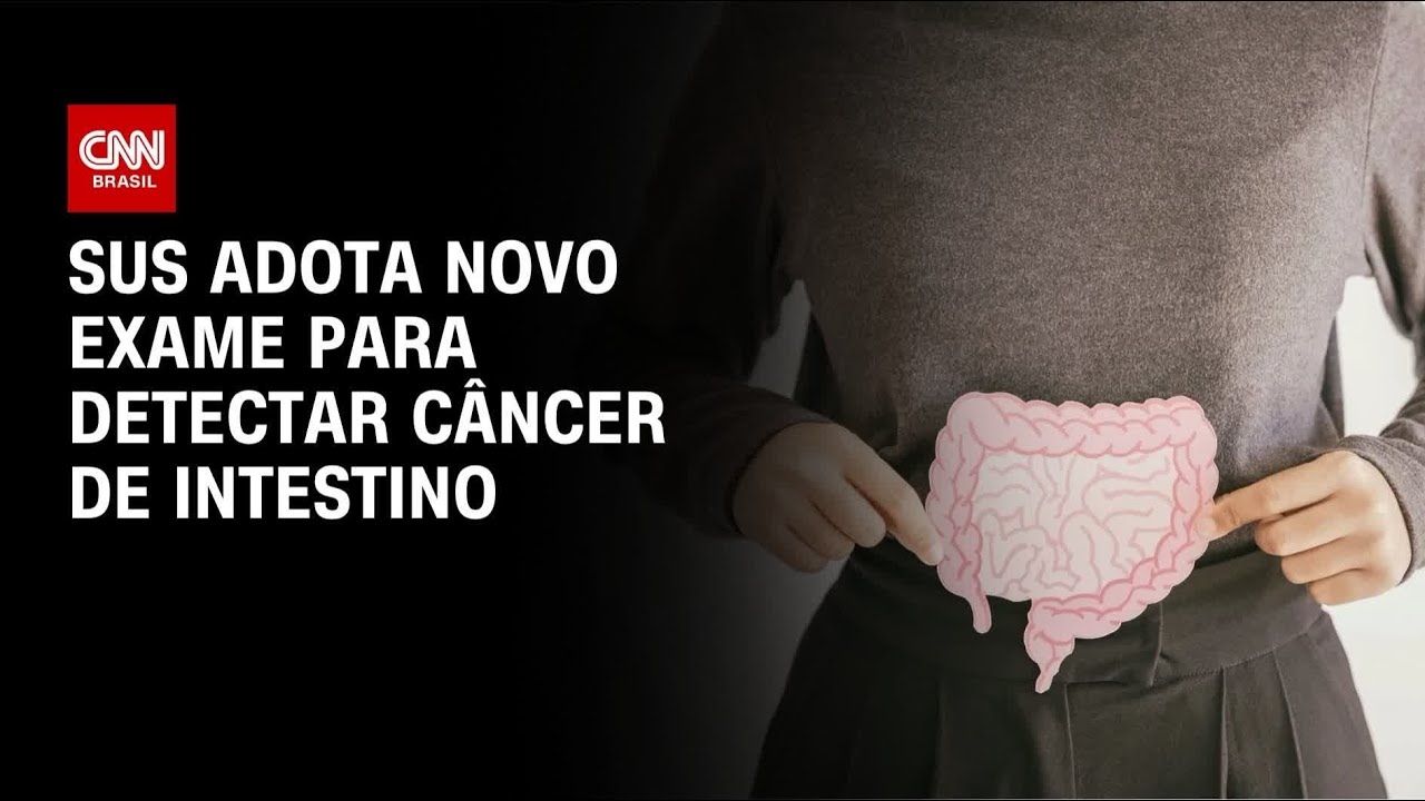 SUS adota novo exame para detectar câncer de intestino antes dos sintomas | CNN 360°