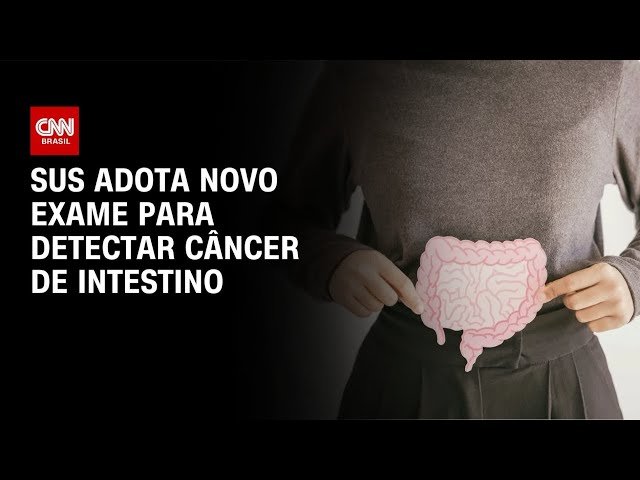 SUS adota novo exame para detectar câncer de intestino antes dos sintomas | CNN 360°
