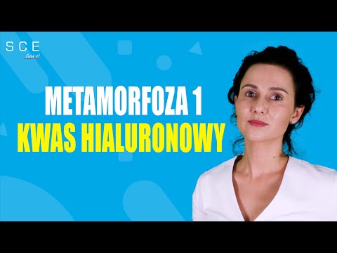 Metamorfoza 1: Kwas Hialuronowy - Dr Król: Medycyna estetyczna odc.3