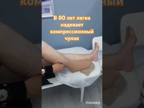 Как за 1 минуту надеть компрессионный чулок. Флеболог Москва.