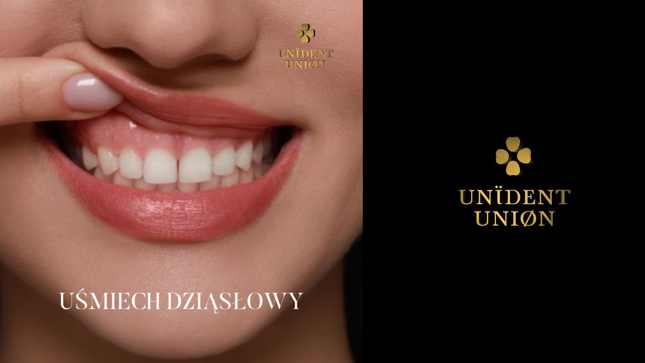 Monika Olejniczak-11