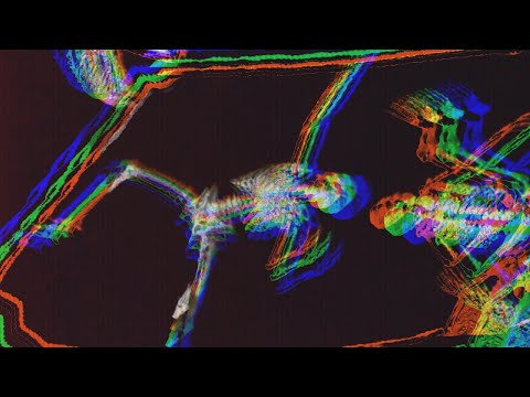 Chemical Brothers - Hey Boy Hey Girl [Eraserhead Acid Bootleg]