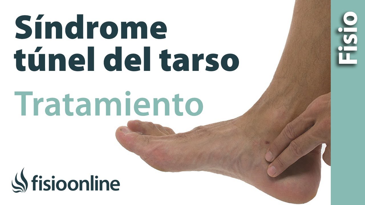 Qué es el Síndrome del túnel del tarso y cuál es su tratamiento.