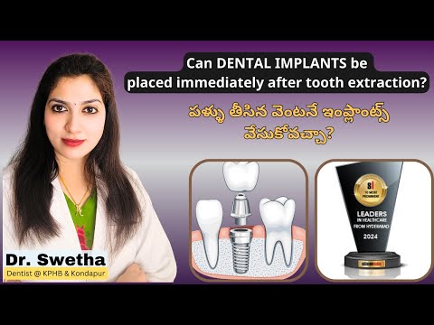 Revolutionary Immediate Dental Implants - Dr. Swetha