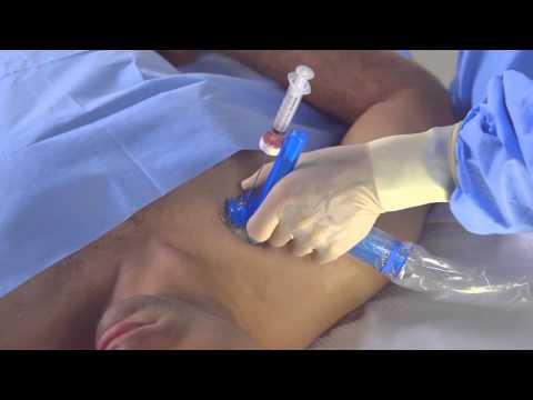 Part 2: Axotrack Tips - Subclavian Vein Central Venous Access