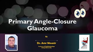 Primary Angle Closure Glaucoma