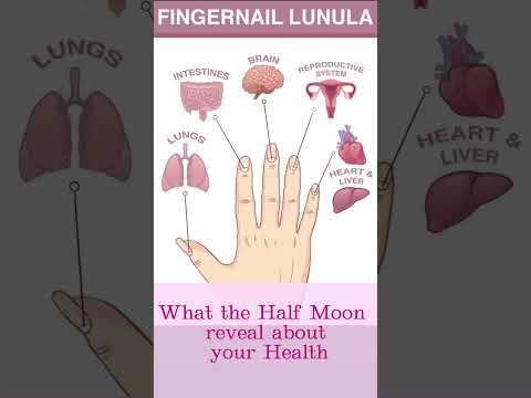 Finger Nail reveal about your health #shorts #youtubeshorts #nails #health