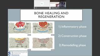 Guarigione e rigenerazione ossea