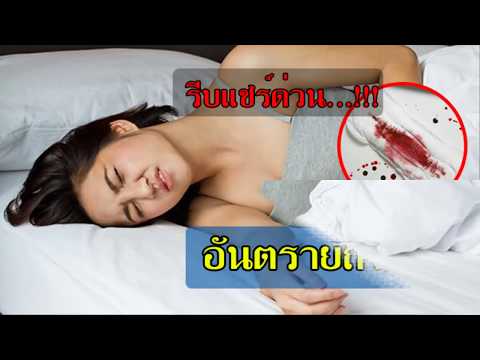 Impaza เพื่อเพิ่มความแข็งแรง วิธีการที่จะยกระดับความแข็งแรงทางเพศ