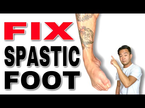 Fix a Spastic Foot Stretches and Exercises | Occupational Therapy