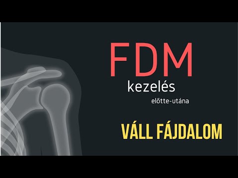 Vállízületi capsulitis