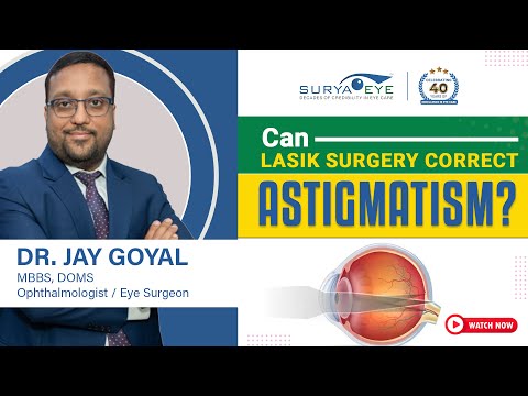 LASIK for Astigmatism: Correcting High Astigmatism and Improving Vision Quality