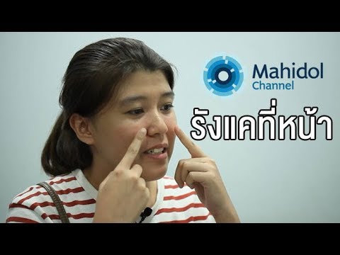 ครีมสุขภาพไซบีเรียกลาก ใช้ยาปฏิชีวนะใด ๆ สำหรับโรคสะเก็ดเงิน