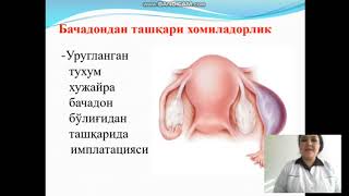 Akusherlikda erta qon ketish