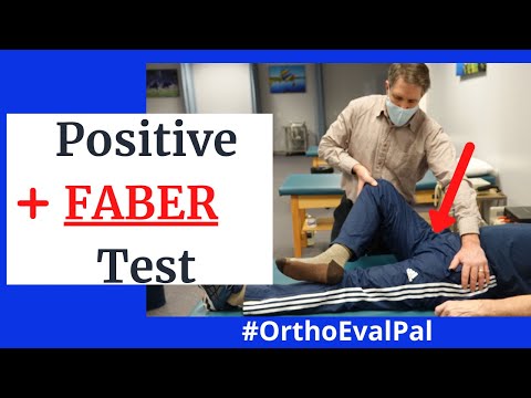 FABER Test (Patrick Test) Positive
