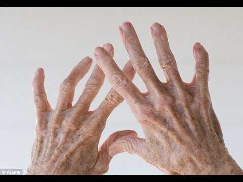 Leczenie psychogennych impotencji Nalczyka Dlatego trzeba środkiem do potencji