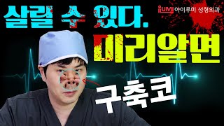 #구축코 자가진단법 - 어..왔ㄴi..? 그리고 잘ㄱr...