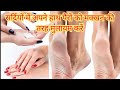 Diy Homemade Best Foot Cream For Dry Crack Heels सर्दियों में सोने स