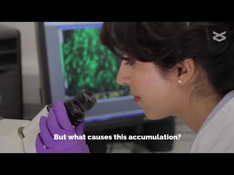 RanGAP helps regulate the lifespan of neural stem cells in Drosophila