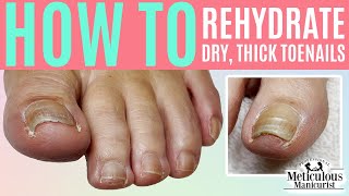👣How to Rehydrate a Dry, Thick Toenail👣