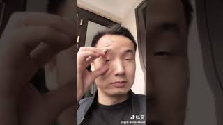 Chinese man has incredibly small eyes
