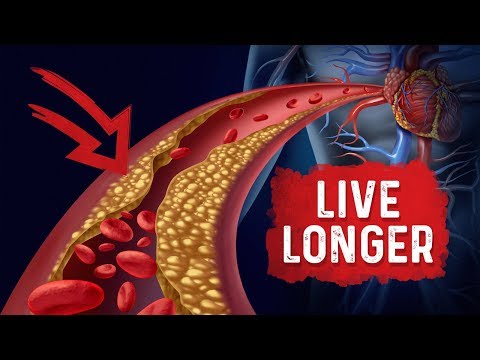 The Real Purpose of Cholesterol – Dr Berg on Cholesterol levels Part 1