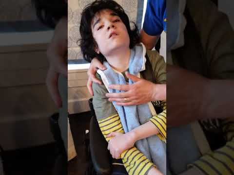 Teen having Generalized Tonic Clonic (GTC, grand mal) seizure