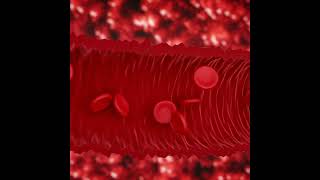 What is Sickle Cell Disease? | #Shorts