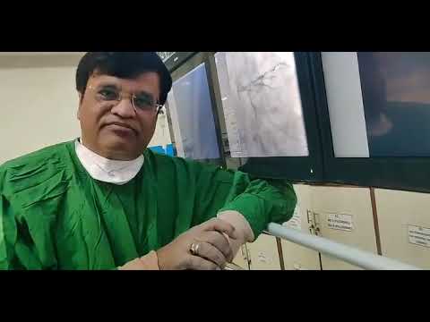 Thrombotic lesion in LAD artery:Approach by Prof Dr Vivek Gupta Sr Cardiologist Apollo 30.3.2022