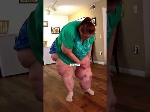 You won’t believe her insane transformation🤯