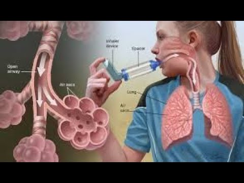 Magonjwa ya mfumo wa hewa  pumu