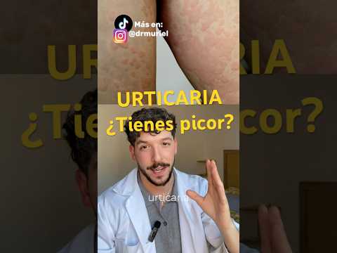 la URTICARIA ronchas o habones por el cuerpo que causan picor#dermatología #piel #urticaria #ronchas