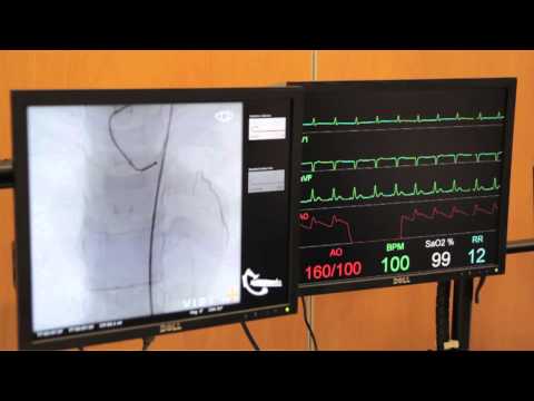 Cardiac Catheterisation Part 1 - Left Coronary
