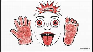 50.2 HSP and Kawasaki Disease