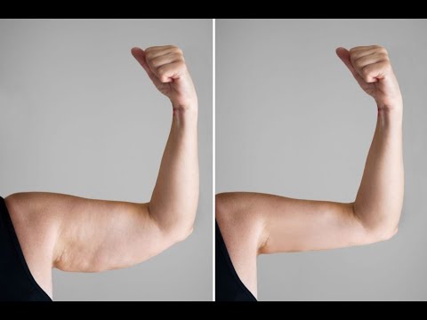 4 EXERCISES BEST FLABBY ARM WORKOUT AT GYM