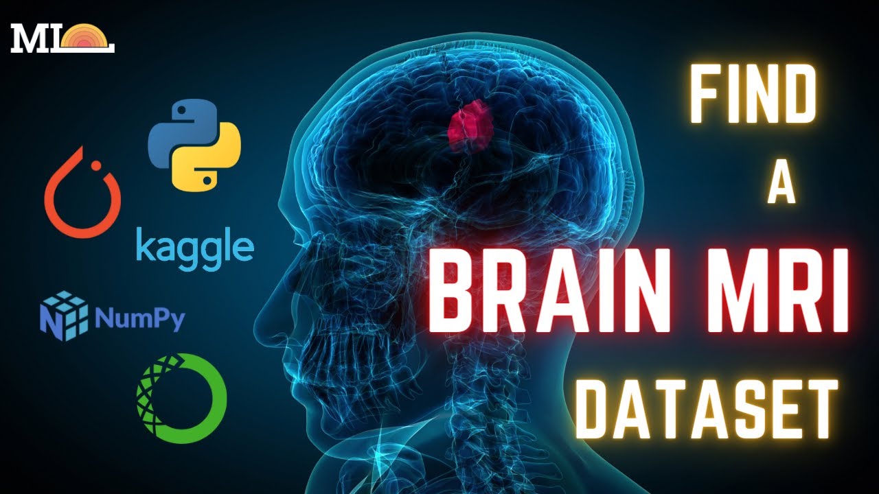 4-Finding a Kaggle Brain MRI Dataset and Importing Packages!