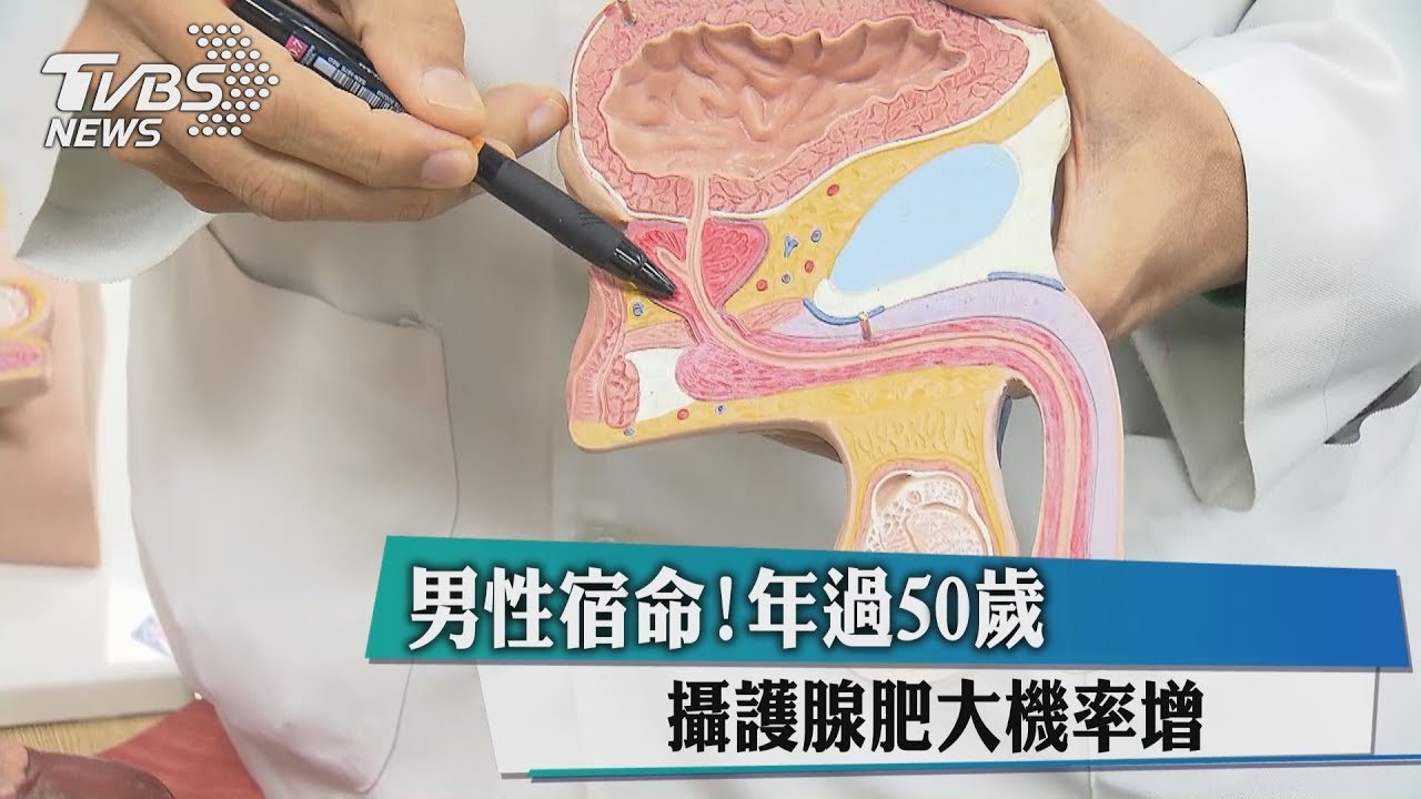 男性宿命！　年過50歲攝護腺肥大機率增